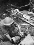 Japanese wounded at Gona, Papua